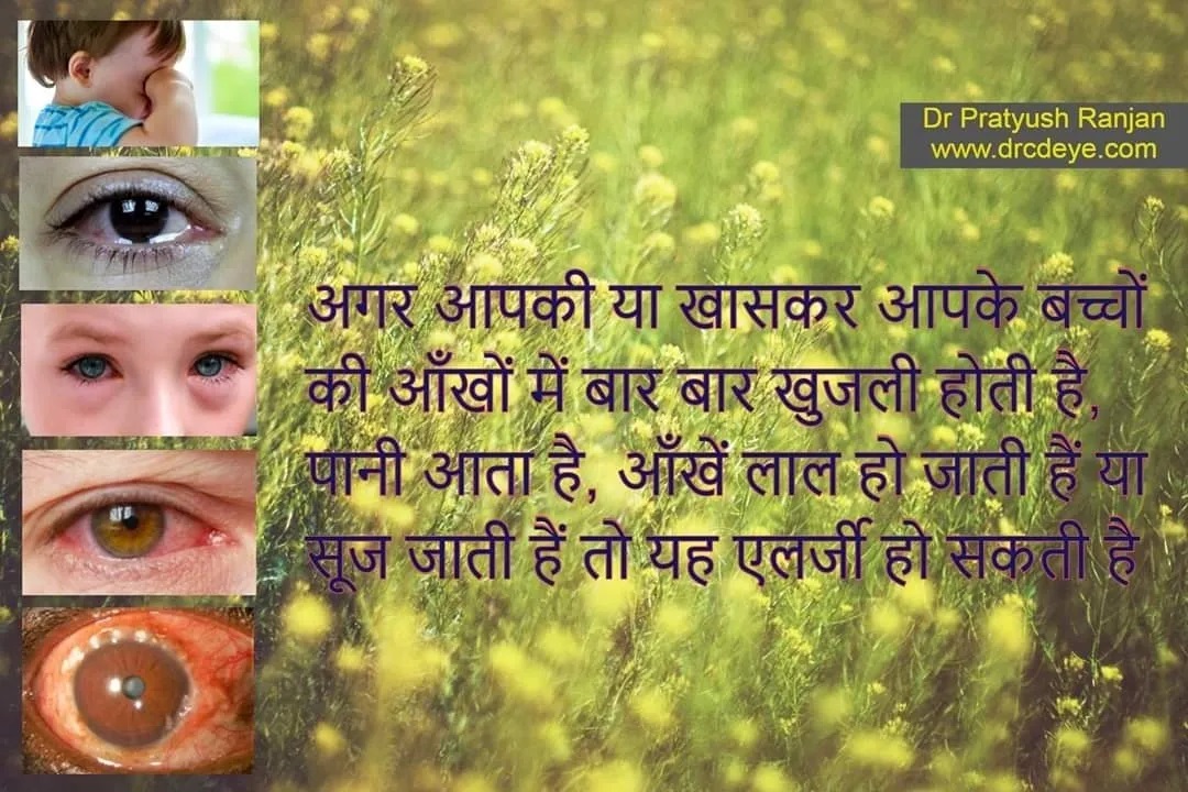 आंखों में लाली और खुजली-एलर्जिक कंजंक्टिवाइटिस (Allergic conjunctivitis)