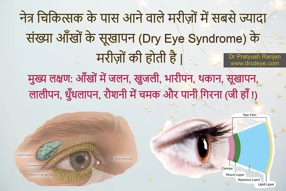 कंप्यूटर विज़न सिंड्रोम